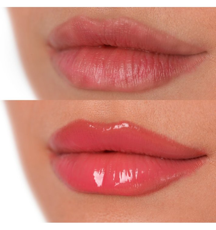 Levelash Levelips | Voluminizador de Labios Profesional y Efecto Lifting