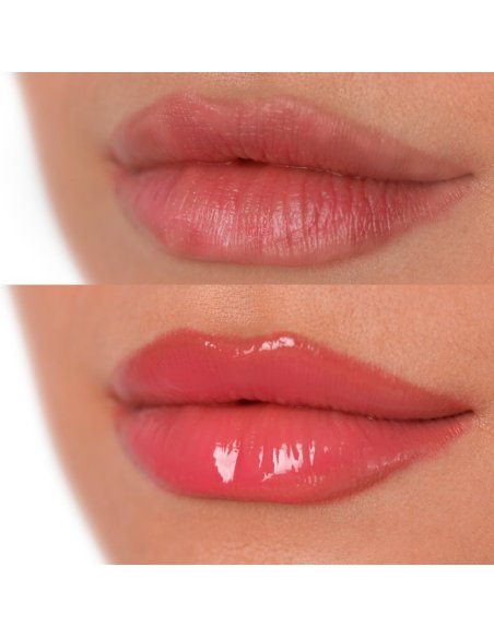 Levelash Levelips | Voluminizador de Labios Profesional y Efecto Lifting