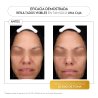 Luxmetique Ritual Hidratación Hyagold | Hyagold Day Formula + Hyagold Night Formula