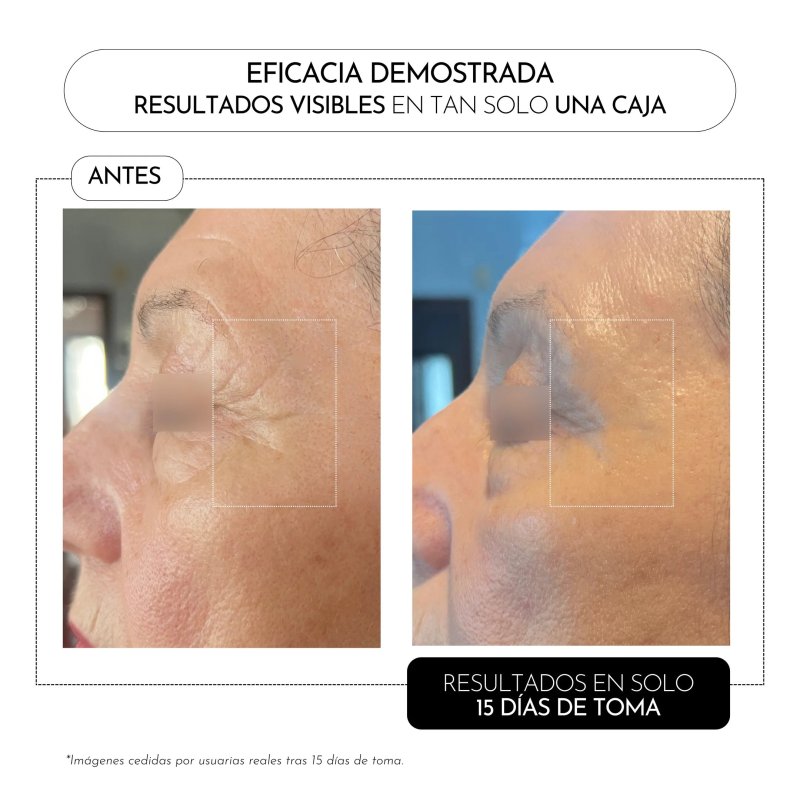 Luxmetique ProAge Day Formula | Complemento Nutricosmético Antiedad de Día