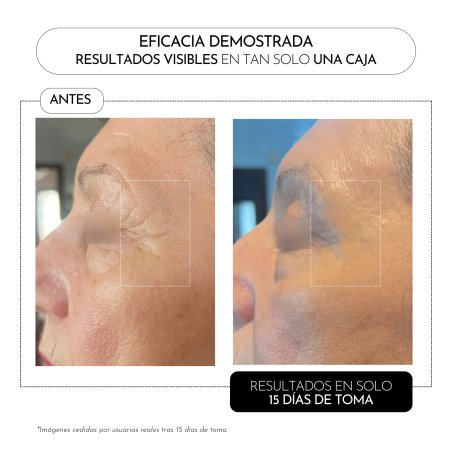 Luxmetique ProAge Day Formula | Complemento Nutricosmético Antiedad de Día