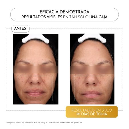 Luxmetique Hyagold Day Formula 15 Viales | Nutricosmética con Ácido Hialurónico para Hidratación y Luminosidad
