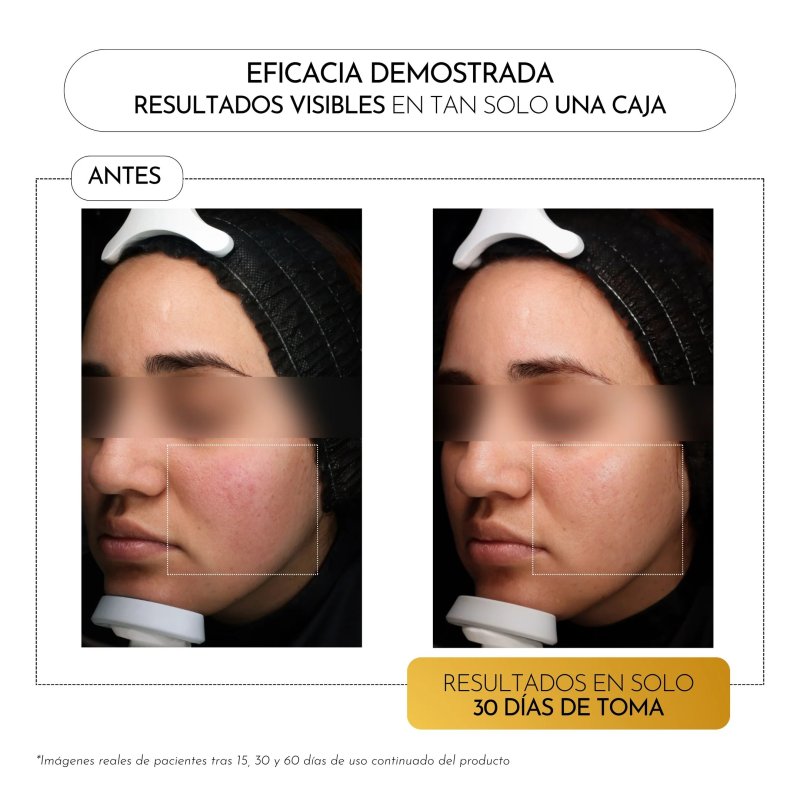 Luxmetique Hyagold Night Formula | Nutricosmético Nocturno con Ácido Hialurónico y GABA
