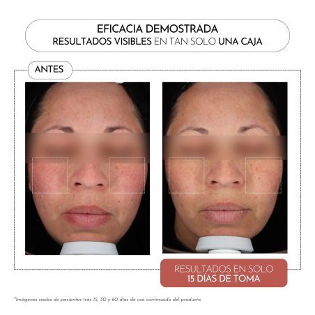 Luxmetique Unifique Formula 60 Comprimidos | Nutricosmético Antimanchas y Unificador del Tono