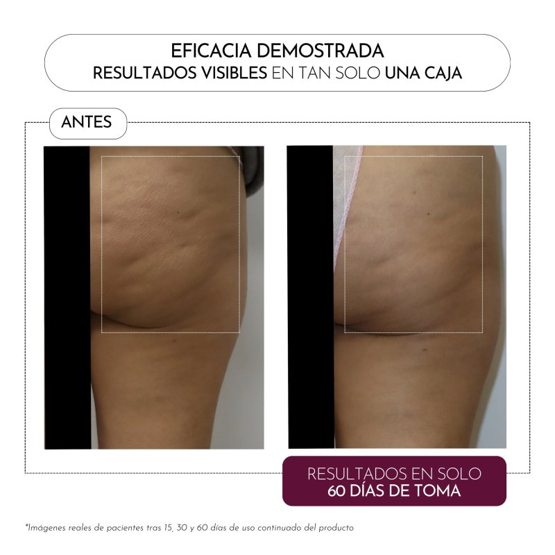Luxmetique Celulox Formula 15 Viales | Nutricosmética Anticelulítica y Circulatoria