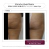 Luxmetique Celulox Formula 15 Viales | Nutricosmética Anticelulítica y Circulatoria