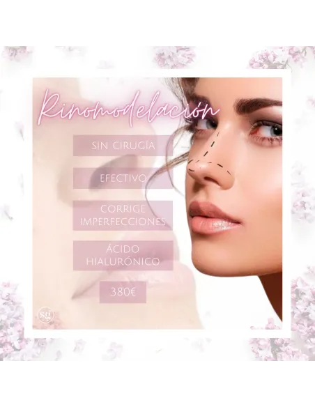Rinomodelación - CENTRE MÈDIC ESTÈTIC SONIA GONZÁLEZ